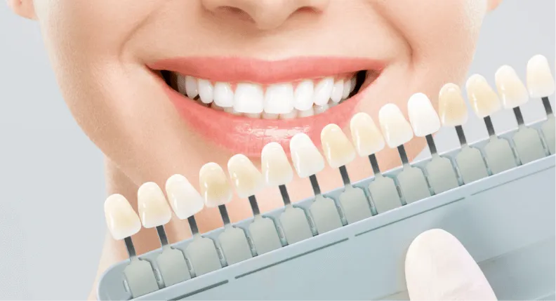 被せ物や詰め物の色を微細に調整